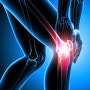[통증치료테이핑] 퇴행성무릎관절염 원인과 증상, 무릎통증완화하는 무릎테이핑 방법