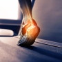 발뒤꿈치통증 혹시 '족저근막염'? 발목테이핑으로 족저근막염 예방하기!