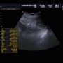 [임신40주1일] 출산전 마지막 진료 / 유도분만 예약