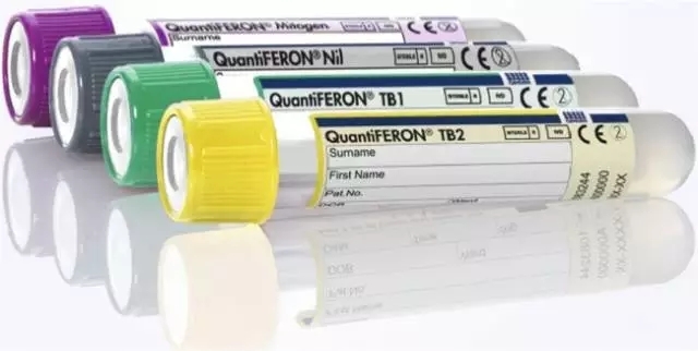 잠복결핵감염 검사, QuantiFERON®-TB Gold Plus : 네이버 블로그