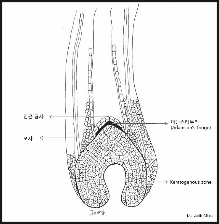 [참고] 아담손 테두리 - 제12장. 백선증(白癬症, Dermatophytosis) - 1. 머리백선증(頭部白癬症, Tinea ...