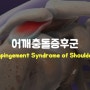 [장안동한의원] 어깨충돌증후군, 견관절 안정화가 중요