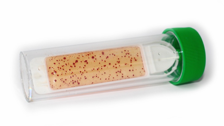 딥슬라이드(dip slide) 측정 결과를 정확하게 해석하고 있습니까? : 네이버 블로그