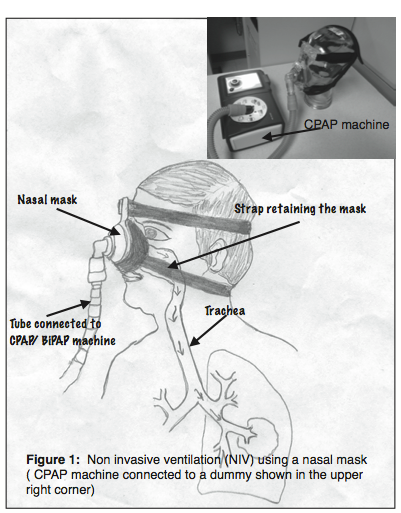 NIV, CPAP, BiPAP : 네이버 블로그