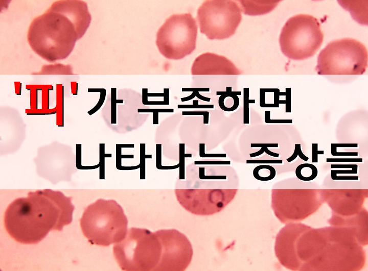 '피' 가 부족하면 나타나는 증상들 : 네이버 블로그