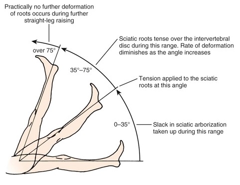 SLRT(Straight leg raising test) : 좌골신경의 신전 테스트 : 네이버 블로그