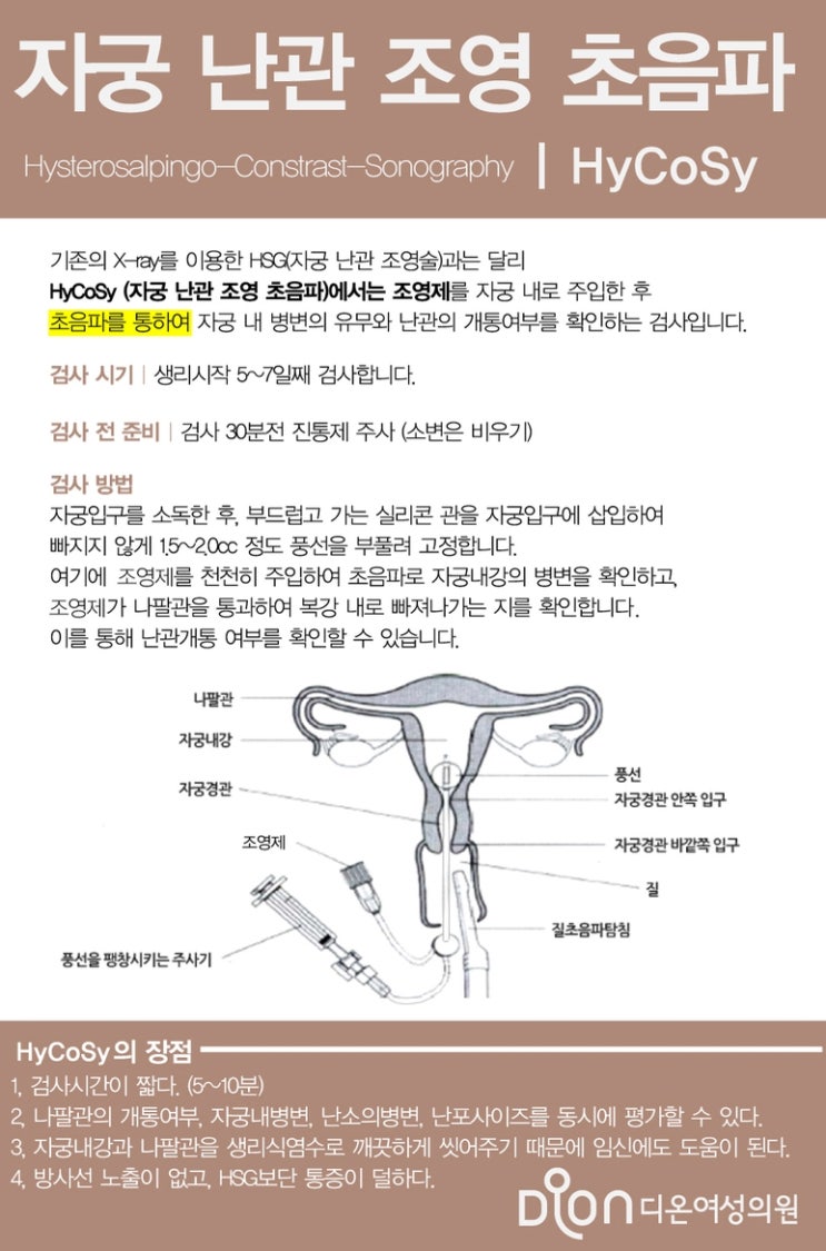 자궁 난관 조영 초음파(HyCoSy) 검사 동탄 난임병원 : 네이버 블로그