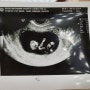 임신 초기 2 : 입덧약 처방과 임신소양증(두드러기) 발생