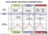 Fetal heart rate sales and contraction monitor