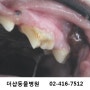 강아지 치아 골절, 강아지 레진치료, 강아지 충치, 더샵동물병원, 송파구동물병원, 신천동동물병원,잠실동물병원