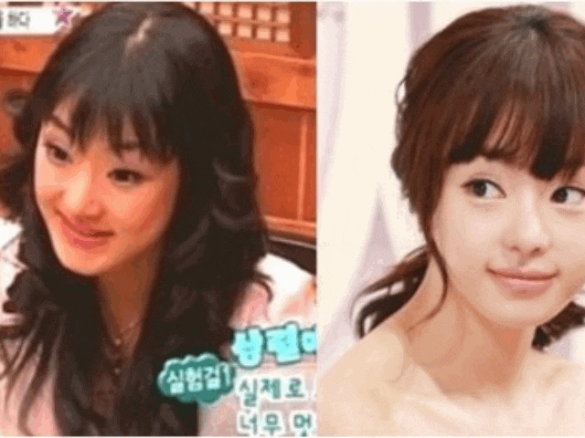 충격적인 성형전후 사진 모음 김남주 강유미 박민영 소이현 이보영 장희진 채정안 한채아 등 성형의힘…쌍꺼풀 가슴 얼굴 코성형 양악 레젼드 여배우 성형외과 연기자 과거 젊은 리즈시절 : 네이버 블로그