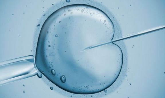 시험관아기 시술 (체외수정시술, IVF-ET) 이란? : 네이버 블로그