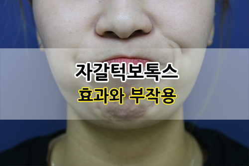 자갈턱보톡스(호두턱 또는 턱끝 보톡스) 효과와 부작용 : 네이버 블로그