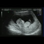 [블랑쉬쇼룸] 임신12주/ 임신12주초음파/ 임신4개월/ 임부복/ 임부원피스/ 임산부원피스