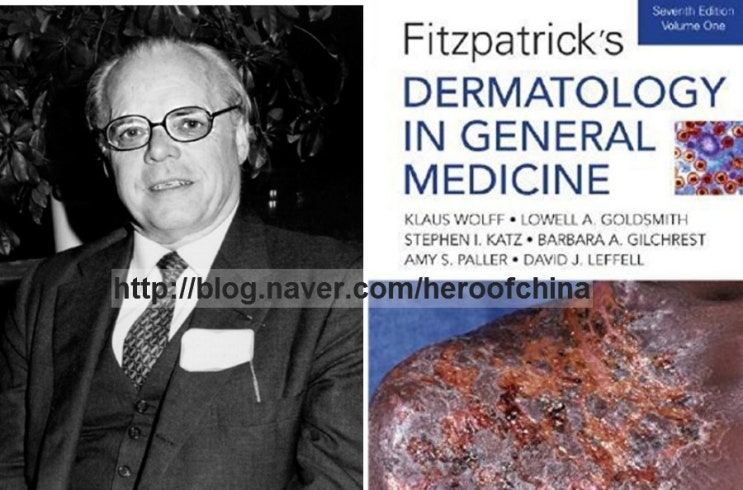 피츠패트릭 피부유형뷴류 (Fitzpatrick classification) : 네이버 블로그