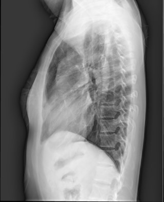 Chest lateral : 네이버 블로그