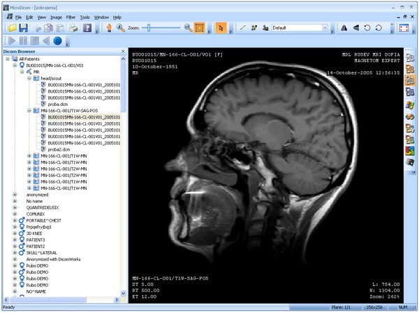 CT MRI 엑스레이 사진 뷰어 프로그램 DICOM Viewer 디콤뷰어 : 네이버 블로그