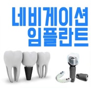 울산치과 네비게이션임플란트 올바른 방법으로!