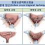 [소아비뇨기과] 방광요관역류의 치료