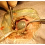 [안과전문동물병원] 녹내장 치료를 위한 실리콘 의안 삽입술(Intrascleral prosthesis) [다나안과동물병원 녹내장 백내장]