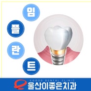 울산치과 틀니임플란트로 건강하게