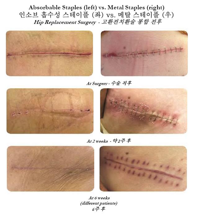온라인 설문 조사 [서베이몽키] 