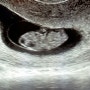 [임신10주]임신9주 끝!10주 시작! 여전한 입덧지옥 -3.5kg