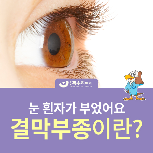 눈 흰자가 부었어요 결막부종 원인은? : 네이버 블로그