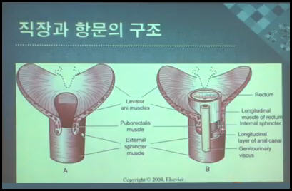 치핵 치료법 및 식생활 가이드 : 네이버 블로그