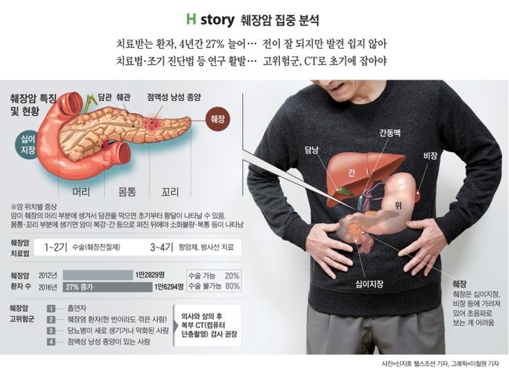 췌장암 집중분석... 생존율 20년째 제자리… : 네이버 블로그