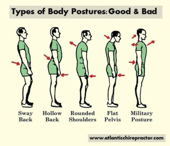 four-types-of-postural-alignment-5-military-type-posture