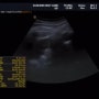 [임신38주] 정기검진 / 내진 / Y자통증