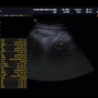[임신39주] 정기검진 / D-5