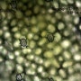 좀개구리밥의 관찰 (현미경 관찰)