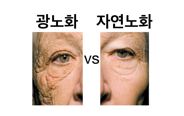 광노화피부 vs 자연적인 피부노화 : 네이버 블로그
