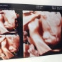 [임신 29주] 입체초음파/청주 산전마사지