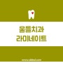 내 치아같은 자연스러운 신정동 라미네이트 :)