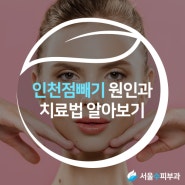 인천점빼기 원인과 치료법 알아보기 [구월동/서울수피부과]