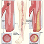 라라올라] 조금만 걸어도 다리가 아프다면?