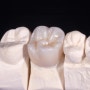 치아 신경치료 마무리 방법, 크라운 종류