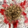 식충식물 네펜데스 알라타의 소화기관 (현미경 관찰)