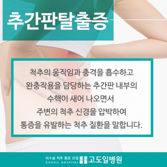 추간판탈출증 비수술로 치료하는법! : 네이버 블로그