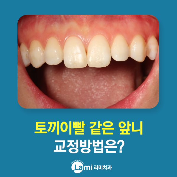 토끼 이빨