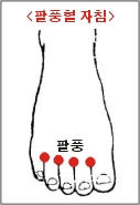 팔풍 : 발등이 부어요. 발가락이 저려요, 발가락이 잘 안굽혀져요 : 네이버 블로그