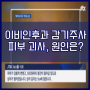 JTBC 팩트체크 [ 이비인후과 피부괴사, 원인은? 과거 유사 사례는? ]