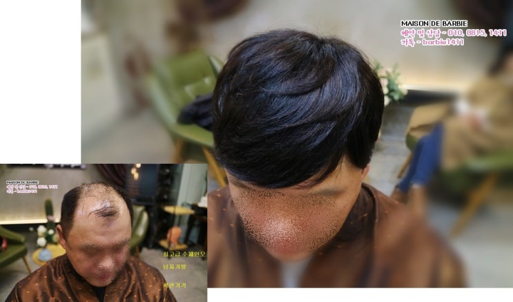 천안미용실 티안나는 최고급 인모 남자가발 합리적인가격으로 만나보는 기회 : 네이버 블로그