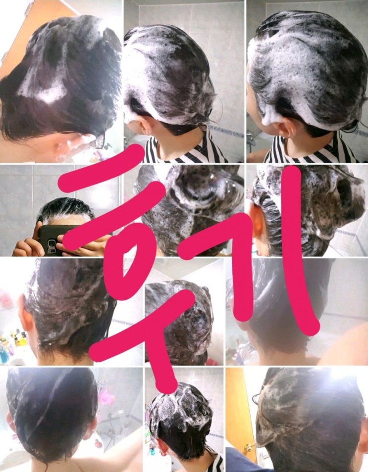 리얼 탈젠 후기, 탈젠 샴푸후기, 탈젠으로 탈모예방 및 탈모진행막기 : 네이버 블로그