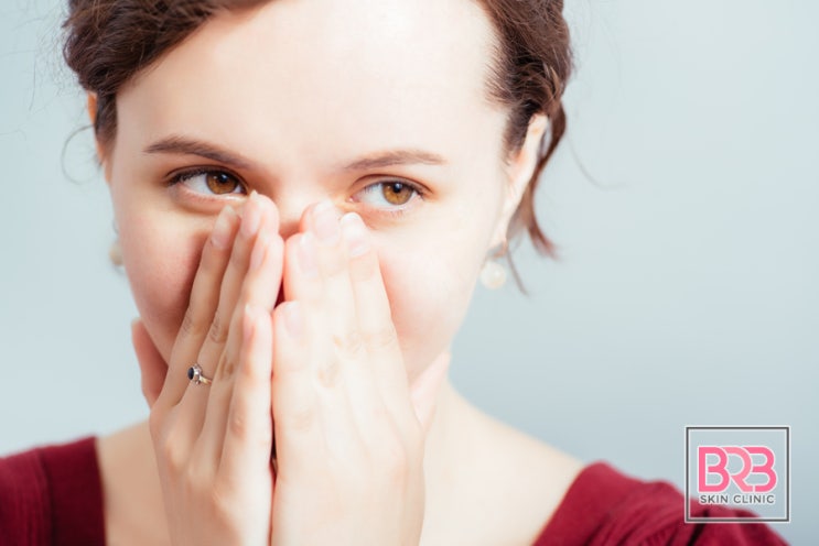 주사피부염이란? 원인과 치료법에 대해서 : 네이버 블로그