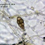 곰팡이에 감염된 회양목 잎 (현미경 관찰)
