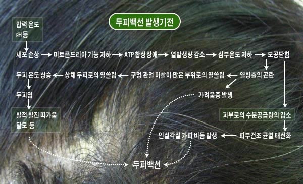 두피 백선, 가려움증, 비듬이 생기는 이유는? : 네이버 블로그